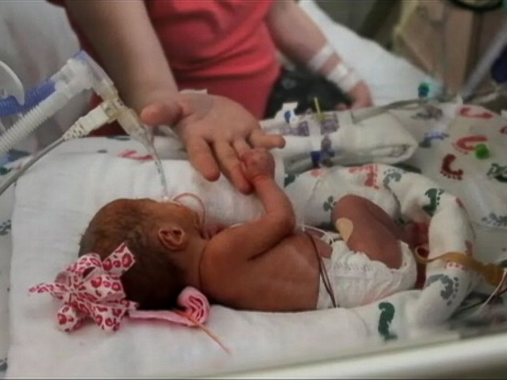 Meet The New Quintuplets Born In Dallas Abc News