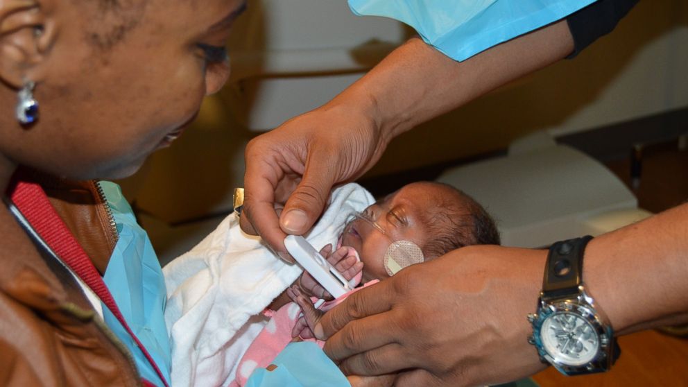 North Carolina Hospital Celebrates 'One of the World's Smallest Babies Ever  Born' - ABC News