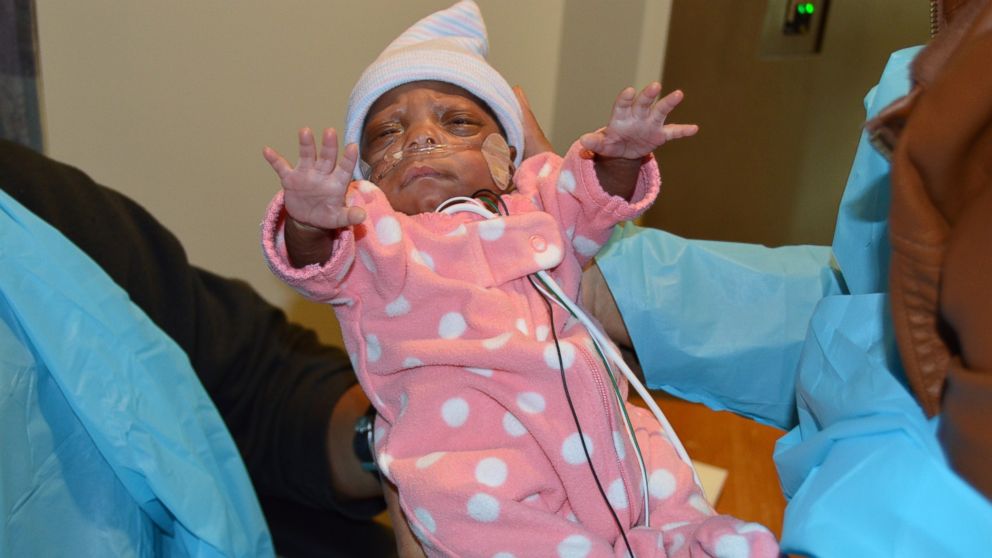North Carolina Hospital Celebrates 'One of the World's Smallest Babies Ever Born' - ABC News