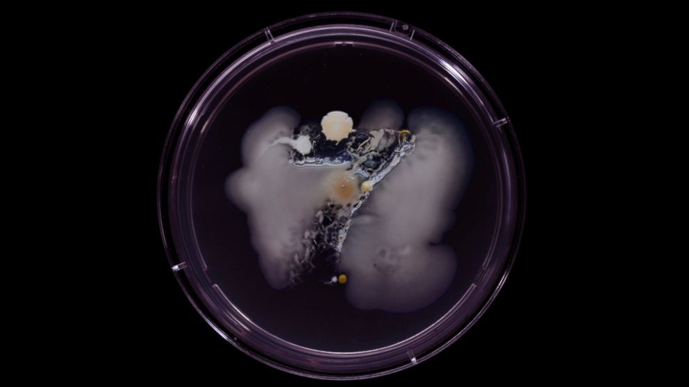 Brooklyn-based illustrator and artist Craig Ward used bacteria from subways, which he grew in Petri dishes to make art. Shown here is bacteria from the 7 train.