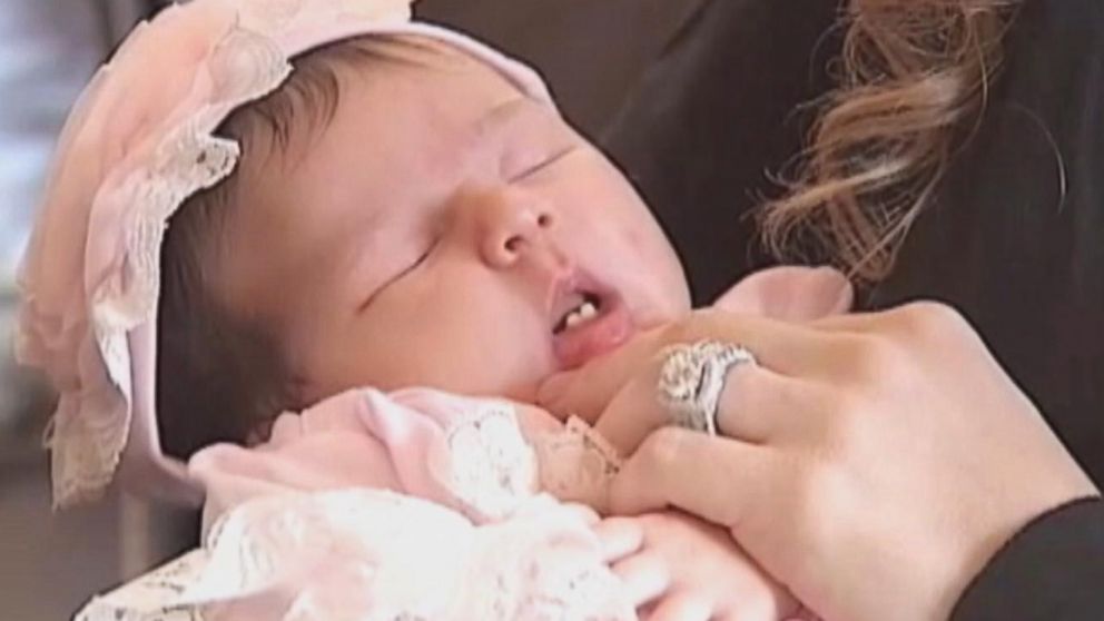 why-this-newborn-s-smile-is-so-rare-abc-news