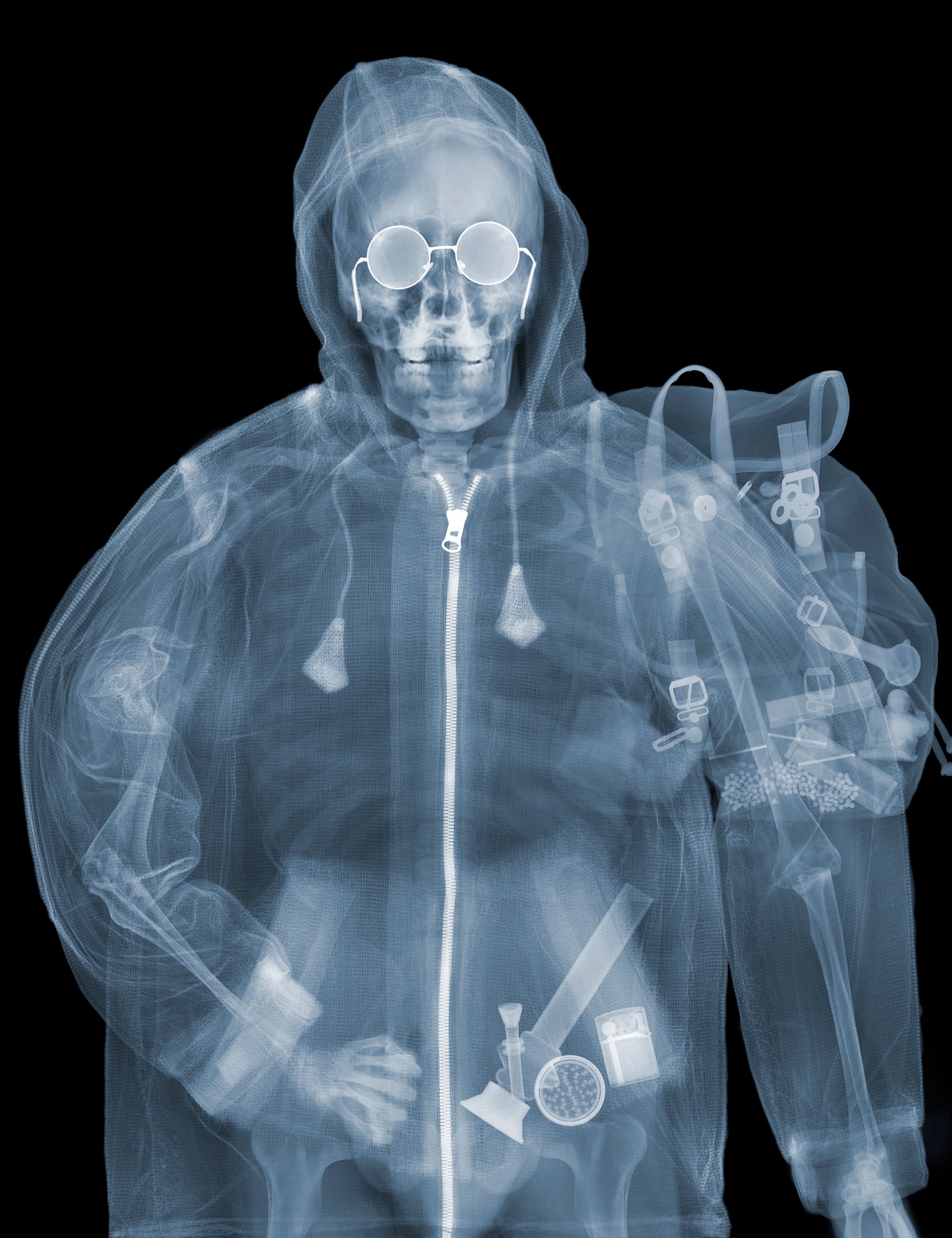 Снимок. Рентгеновские снимки Ника визи:. Ник визи. X-ray men. Рентген Nick Veasey. Необычные рентген снимки.