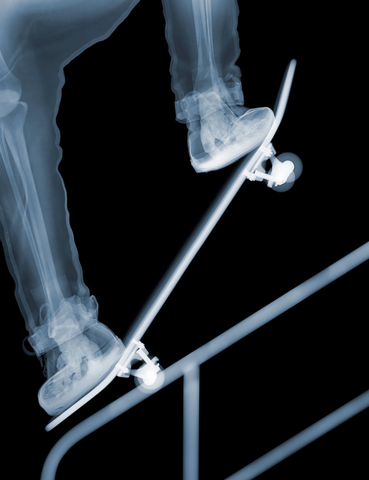 Skater Picture Nick Veasey S X Ray Art Abc News