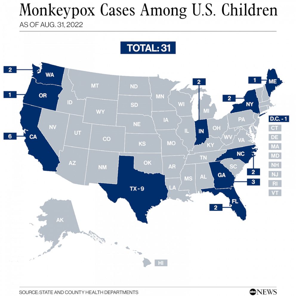 PHOTO: Monkeypox Cases Among U.S. Children