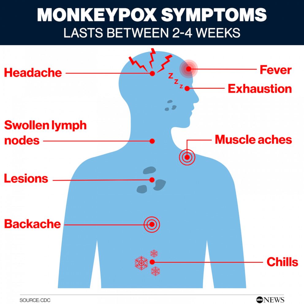 PHOTO: Monkeypox symptoms