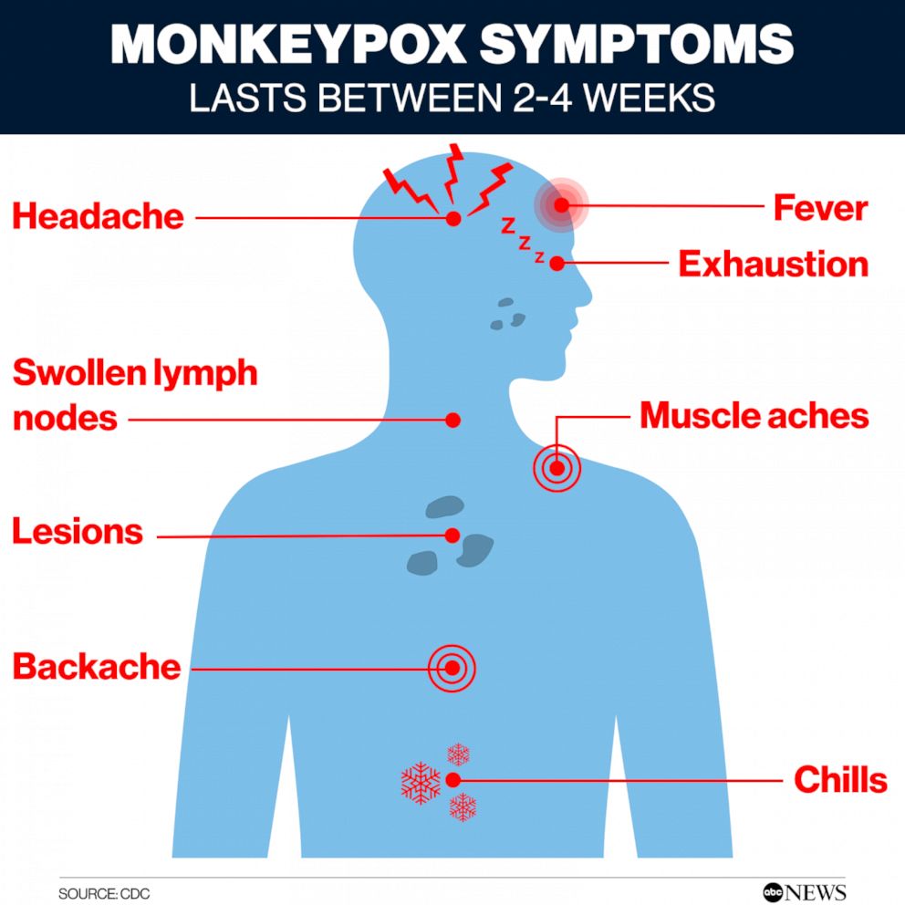 What Is Monkeypox: Symptoms, Pictures, and Treatment