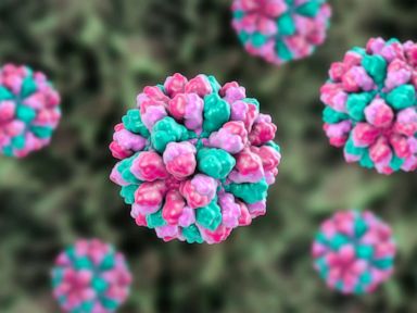 4 in 10 restaurant foodborne illness outbreaks caused by sick workers: CDC report