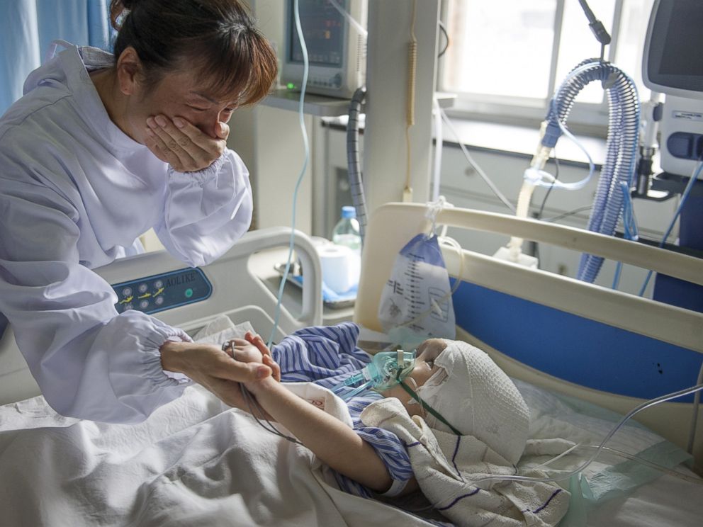 PHOTO: Three-year-old Hanhan is seen after a surgery to implant three pieces of titanium mesh to replace her skull, as her aunt cries while holding her hand at a hospital in Changsha, Hunan province, China, July 15, 2015. 