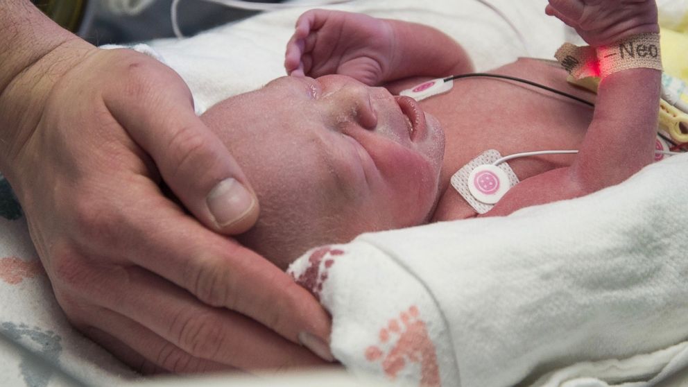 VIDEO: First American baby born to a mother who received transplanted uterus 