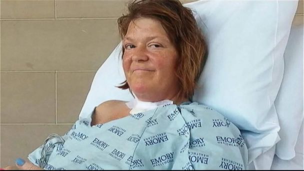 Georgia Woman's 'Long Road to Recovery' From Flesh-Eating Bacteria ...