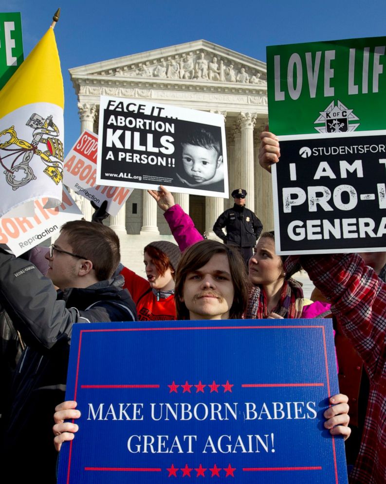 Number Of Abortions In Us Falls To Lowest Since 1973 Abc News