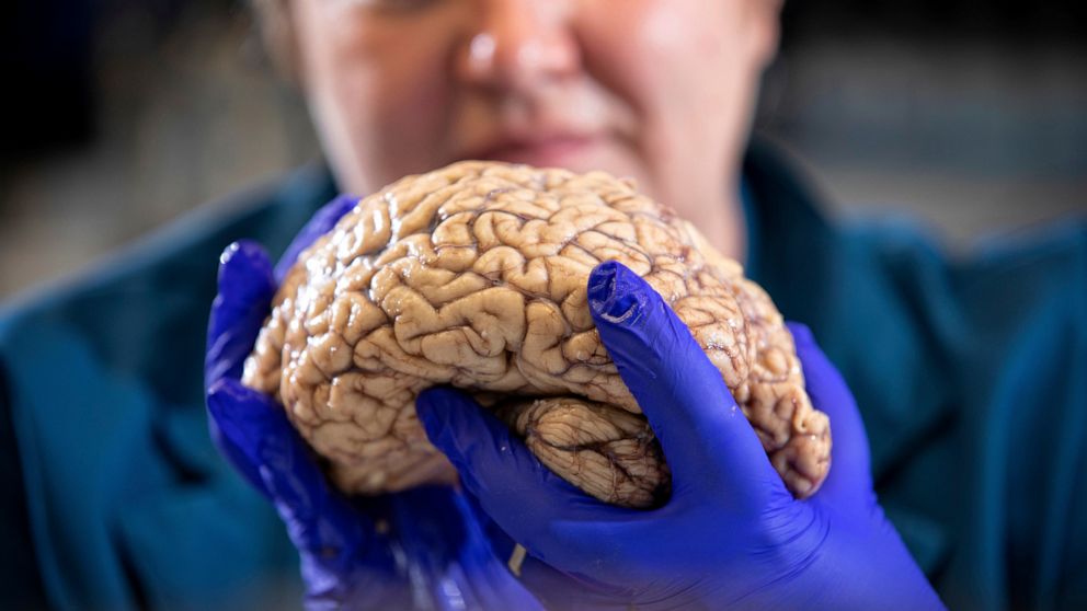 Scientists rethink Alzheimer's, diversifying the drug search