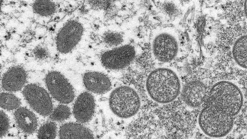 FILE - This 2003 electron microscope image made available by the Centers for Disease Control and Prevention shows mature, oval-shaped monkeypox virions, left, and spherical immature virions, right, obtained from a sample of human skin associated with