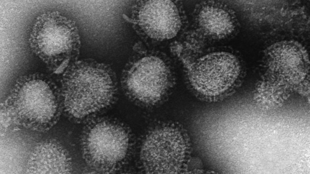 This 1975 electron microscope image made available by the Centers for Disease Control and Prevention shows a group of H3N2 influenza A virus virions. On Friday, March 8, 2019, health officials said there’s a strong chance this flu season has peaked, 