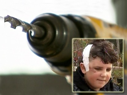 VIDEO: Doctor uses handymans drill to save a boys life.