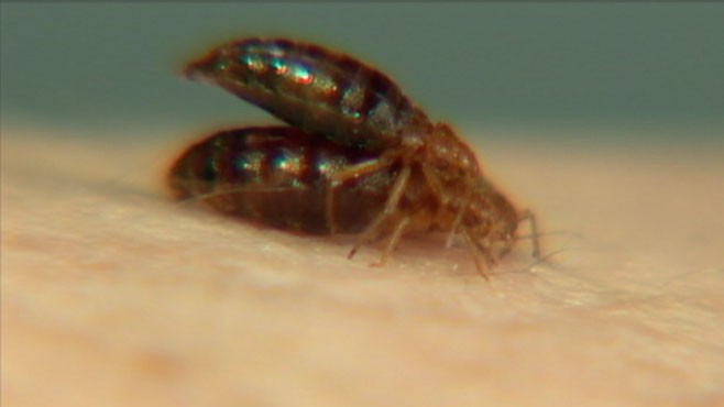 Scientist Study Genetic Makeup of the Bedbug - ABC News