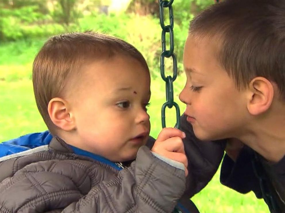 PHOTO: Avery Fitzgerald, 2, of Rockford, Ill. plays with his brother after his left eye was removed due to cancer.