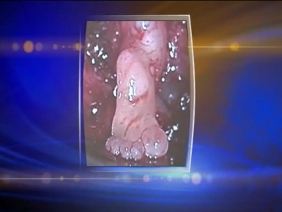 Baby Foot Brain
