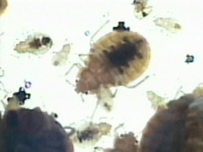 VIDEO: How to take care of bedbugs and other night crawlers invading your bed.