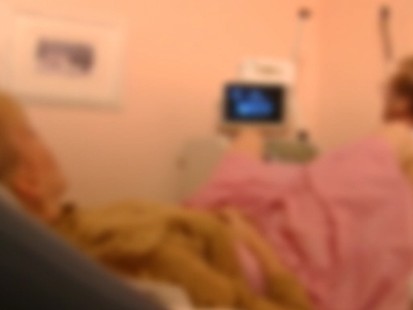 VIDEO: Minimally Invasive Birth Control Device