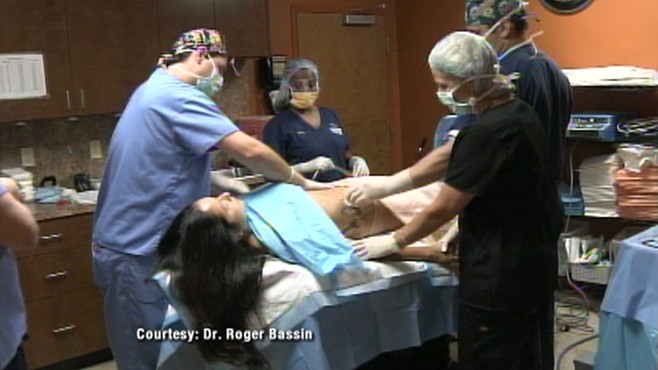 Natural Breast Augmentation Natural Breast Augmentation