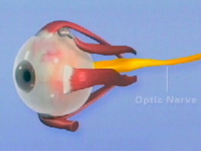 VIDEO: Keeping an Eye on Glaucoma