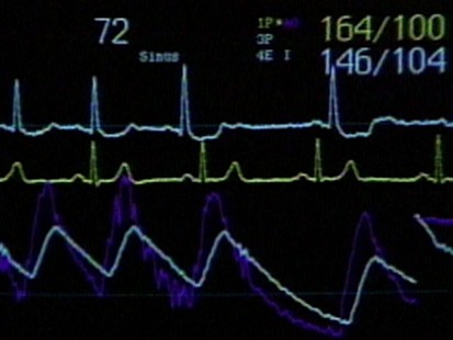 VIDEO: Deadly heart attacks