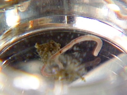 VIDEO: Does Your Bikini Have Bugs?