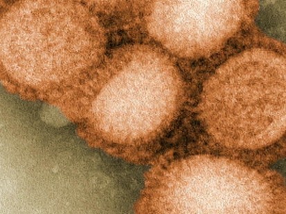 VIDEO: Safeguarding Yourself Against Swine Flu