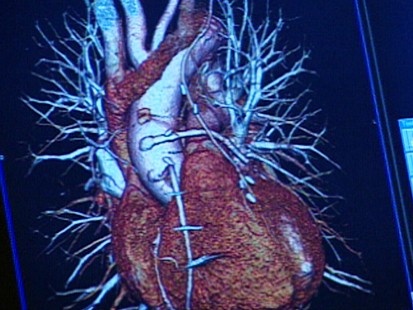 VIDEO: Heart Health