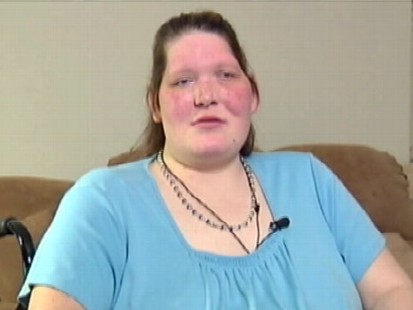 VIDEO: A California doctor says he might be able to stop Tanya Anguss growth.
