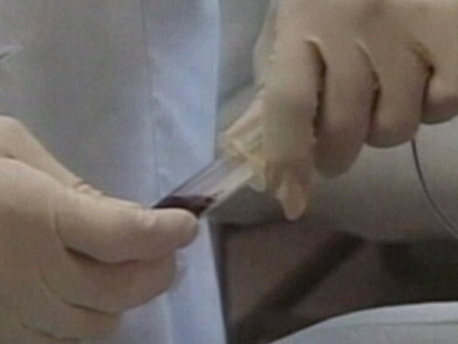 Video: new HIV gel could stop the spread of HIV in women.