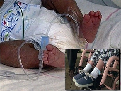 Premature Babies at Risk