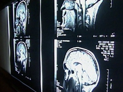 VIDEO: Medical radiation exposure