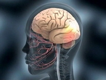 VIDEO: Antidepressants May Change Personality