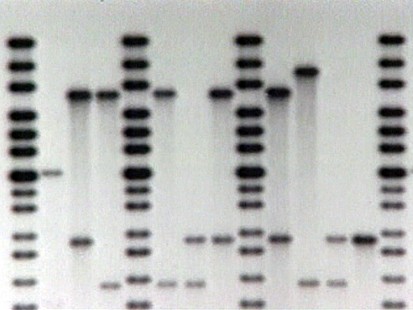 VIDEO: Autism and Genes