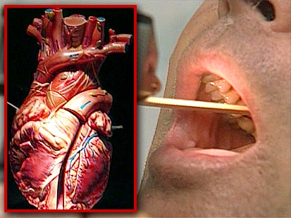 VIDEO: Strep Throat and Heart Damage