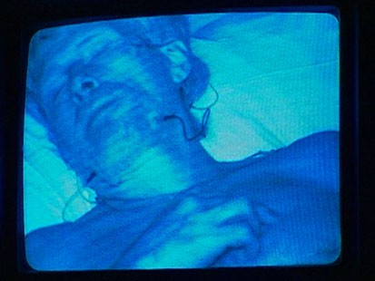 VIDEO: Chronic Sleep Loss Cannot Be Made Up Later