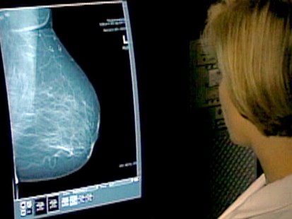 VIDEO: Study compares mammography and MRI screening for women at risk of breast cancer.