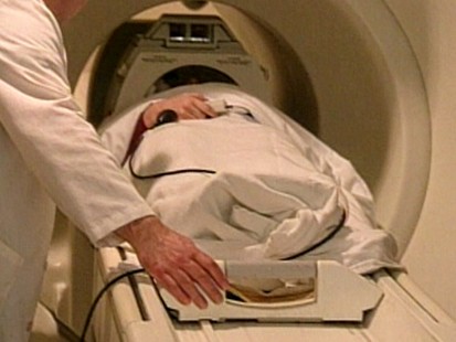 VIDEO: Gender bias in stroke treatment