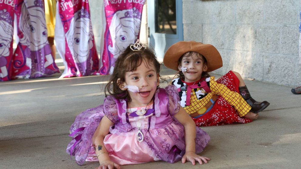 Formerly conjoined twins Eva and Erika Sandoval are seen here celebrating their third birthday.