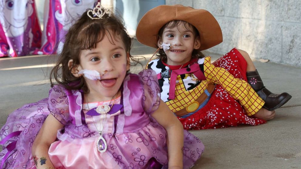 Formerly conjoined twins Eva and Erika Sandoval are seen here celebrating their third birthday.
