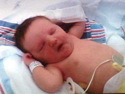 VIDEO: A newborn in Alabama has been born with paralyzed vocal chords.