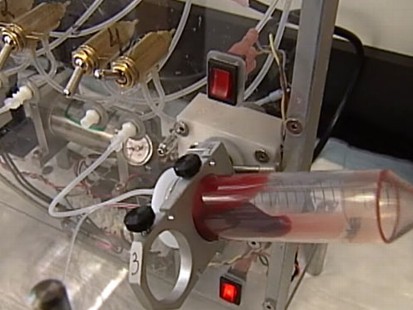 VIDEO: Cancer-cell scanner could have implications for future detection and treatment.