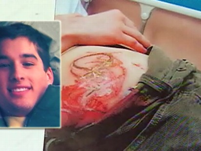 VIDEO: Amon Carter IV says he was branded by his fraternity brothers while passed out.
