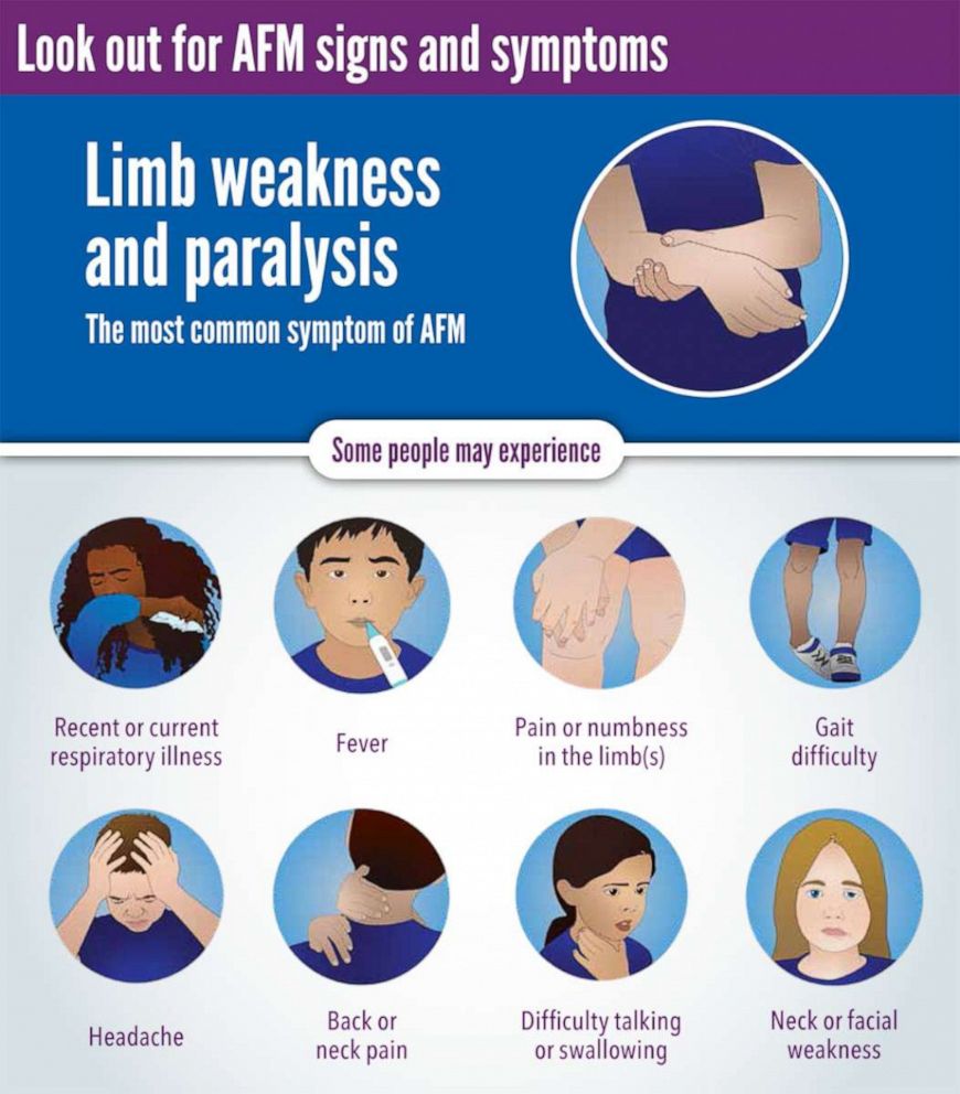 CDCAn AFM infographic.