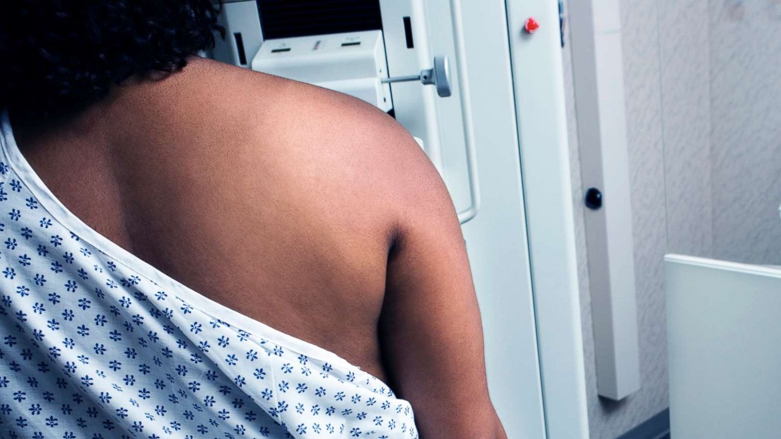 PHOTO: In this undated stock photo an African American woman getting a mammogram.