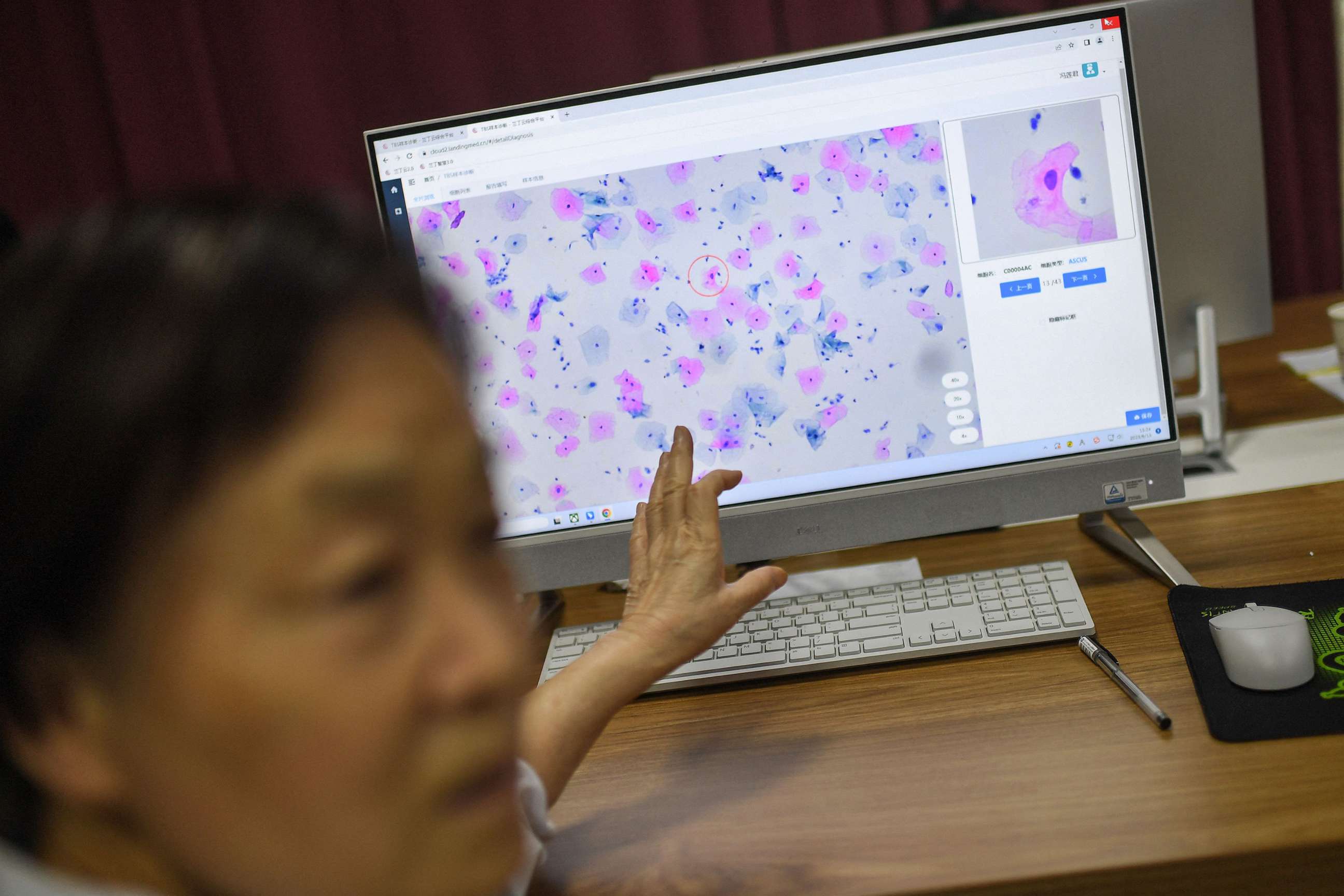 PHOTO: A laboratory technician conducts artificial intelligence (AI)-based cervical cancer screening at a test facility in Wuhan, in China's central Hubei province, June 15, 2023.