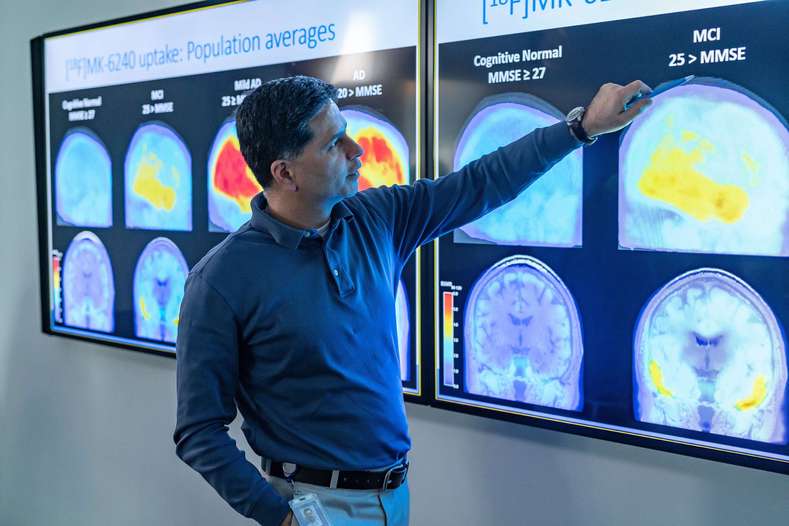 PHOTO: A man points to images of the brain in a handout photo released by Biogen in connection with the approval of their Alzheimer's medication Aduhelm, in Cambridge, Mass., June 8, 2021.