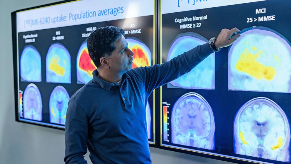 PHOTO: A man points to images of the brain in a handout photo released by Biogen in connection with the approval of their Alzheimer's medication Aduhelm, in Cambridge, Mass., June 8, 2021.